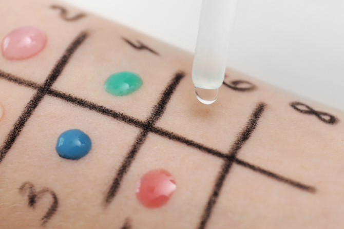 Testy punktowe skórne: Prosta droga do zrozumienia Twoich alergii